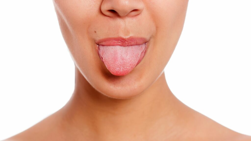 What Does the Tongue Say About Your Health?