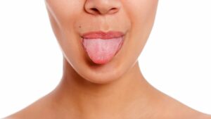 What Does the Tongue Say About Your Health?