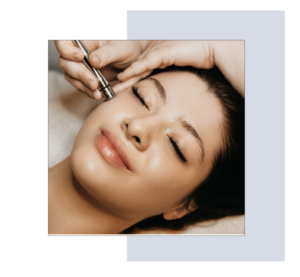 Microneedling