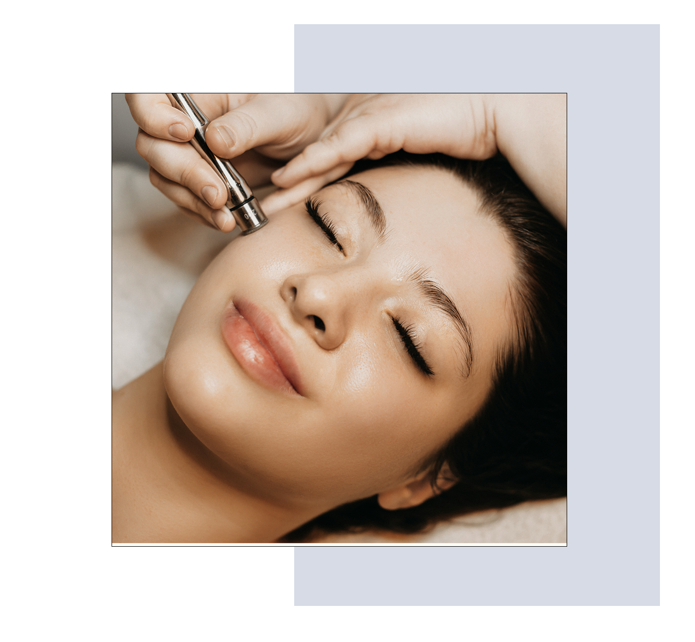 Microneedling